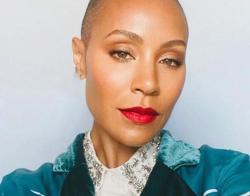 Famosos que padecen alopecia